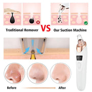 5-in-1 Rechargeable Blackhead Remover – Deep Cleanse & Radiant Skin
